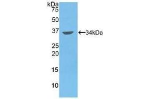 Detection of Recombinant MMP7, Human using Polyclonal Antibody to Matrix Metalloproteinase 7 (MMP7) (MMP7 抗体  (AA 1-267))