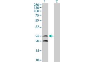 Western Blot analysis of IL6 expression in transfected 293T cell line by IL6 monoclonal antibody (M08), clone 2C5. (IL-6 抗体  (AA 29-212))