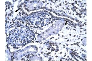 FOXG1A antibody was used for immunohistochemistry at a concentration of 4-8 ug/ml to stain Epithelial cells of renal tubule (arrows) in Human Kidney. (FOXG1 抗体  (N-Term))