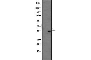 Western blot analysis of OR1L3 expression in HepG2 cell lysate ;,The lane on the left is treated with the antigen-specific peptide. (OR1L3 抗体  (C-Term))