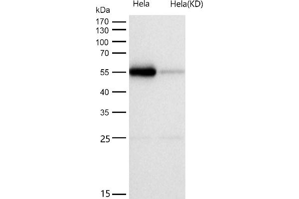 Recombinant Primary Retinal Dysplasia (PRD) 抗体