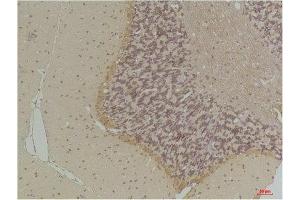 Immunohistochemistry (IHC) analysis of paraffin-embedded Rat Brain Tissue using GABA Transporter 1 Rabbit Polyclonal Antibody diluted at 1:200. (SLC6A1 抗体)