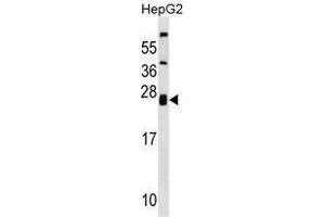 ZNRF1 Antibody (Center) western blot analysis in HepG2 cell line lysates (35 µg/lane). (ZNRF1 抗体  (Middle Region))