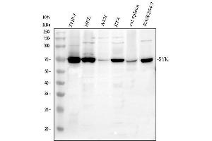 Western blot analysis of SYK using anti-SYK antibody (ABIN7599608).