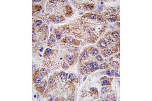 Immunohistochemistry (IHC) image for anti-Farnesyl Diphosphate Synthase (FDPS) antibody (ABIN3001523) (FDPS 抗体)