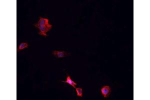 ABIN6266742 staining Hek293 cells by IF/ICC.