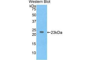 Western Blotting (WB) image for anti-Interleukin 17 Receptor B (IL17RB) (AA 310-499) antibody (ABIN1859361) (IL17 Receptor B 抗体  (AA 310-499))