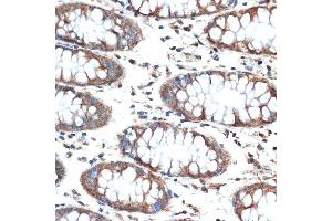 Immunohistochemistry of paraffin-embedded human colon using MUC4 Rabbit mAb (ABIN7268692) at dilution of 1:100 (40x lens). (MUC4 抗体)