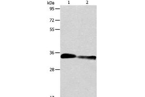 Western Blot analysis of Mouse kidney and Rat kidney tissue using ACY3 Polyclonal Antibody at dilution of 1:750 (Aminoacylase 3 抗体)