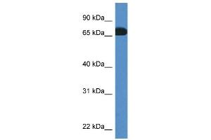 WB Suggested Anti-Pros1 Antibody Titration: 1. (PROS1 抗体  (C-Term))