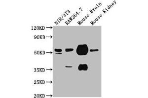 Western Blotting (WB) image for anti-Tubulin, alpha 1a (Tuba1a) antibody (ABIN7127861)