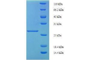 SDS-PAGE (SDS) image for Inhibin, beta A (INHBA) (AA 311-426) protein (His-SUMO Tag) (ABIN5709761)