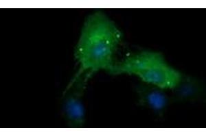Image no. 3 for anti-Cancer/testis Antigen 1B (CTAG1B) antibody (ABIN1499890) (CTAG1B 抗体)