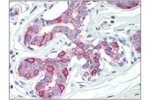 Human Breast: Formalin-Fixed, Paraffin-Embedded (FFPE) (PKMYT1 抗体  (Internal Region))
