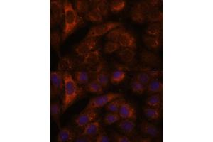 Immunofluorescence analysis of U-2 OS cells using HEBP2 antibody (ABIN7267604) at dilution of 1:100. (HEBP2 抗体  (AA 1-205))