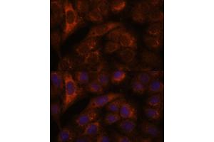 Immunofluorescence analysis of U-2 OS cells using HEBP2 antibody (ABIN7267604) at dilution of 1:100. (HEBP2 抗体  (AA 1-205))
