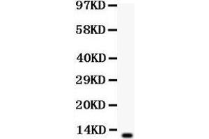 Anti-beta Defensin 1 antibody,Western blotting All lanes: Anti Defensin 1  at 0. (beta Defensin 1 抗体  (C-Term))