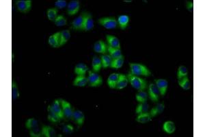 Immunofluorescence staining of Hela cells with ABIN7164887 at 1:66, counter-stained with DAPI. (PTOV1 抗体  (AA 2-137))