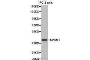 Western Blotting (WB) image for anti-Sperm Adhesion Molecule 1 (PH-20 Hyaluronidase, Zona Pellucida Binding) (SPAM1) antibody (ABIN1874917) (SPAM1 抗体)