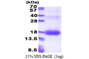 SDS-PAGE (SDS) image for Zinc Ribbon Domain Containing 1 (ZNRD1) (AA 1-126) protein (His tag) (ABIN5853336) (ZNRD1 Protein (AA 1-126) (His tag))