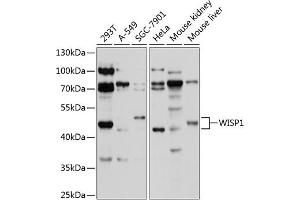 Western blot analysis of extracts of various cell lines, using WISP1 antibody (ABIN1683290, ABIN3017735, ABIN3017736 and ABIN6220223) at 1:1000 dilution. (WISP1 抗体  (AA 158-367))