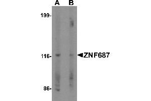 Western blot analysis of ZNF687 in Jurkat cell lysate with ZNF687 antibody at 0. (ZNF687 抗体  (C-Term))