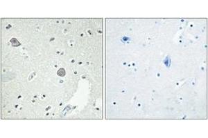 Immunohistochemistry analysis of paraffin-embedded human brain tissue, using DRD1 Antibody. (Dopamine Receptor d1 抗体  (AA 135-184))