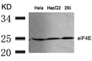 Image no. 3 for anti-Eukaryotic Translation Initiation Factor 4E (EIF4E) (Ser209) antibody (ABIN197473) (EIF4E 抗体  (Ser209))