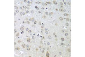 Immunohistochemistry (Paraffin-embedded Sections) (IHC (p)) image for anti-Acetylcholinesterase (AChE) (AA 398-617) antibody (ABIN3016743)