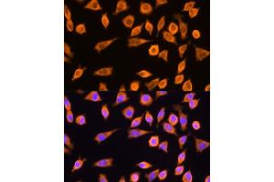 Immunofluorescence (IF) image for anti-Ribosomal Protein L17 (RPL17) (AA 1-184) antibody (ABIN6147115)