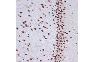 Immunohistochemistry of paraffin-embedded rat brain using A Rabbit mAb (ABIN7265387) at dilution of 1:100 (40x lens). (BAF53A 抗体)