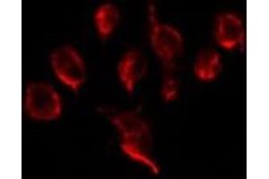 Immunofluorescence (fixed cells) (IF/ICC) image for anti-Parathyroid Hormone 1 Receptor (PTH1R) (pThr1) antibody (ABIN6257431)
