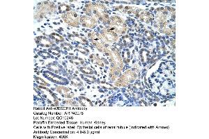 Rabbit Anti-WBSCR1 Antibody  Paraffin Embedded Tissue: Human Kidney Cellular Data: Epithelial cells of renal tubule Antibody Concentration: 4. (EIF4H 抗体  (Middle Region))