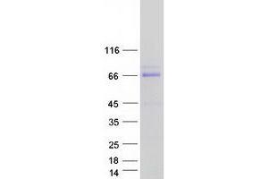 Western Blotting (WB) image for Activating Transcription Factor 7 (ATF7) (Transcript Variant 1) protein (Myc-DYKDDDDK Tag) (ABIN2715707)