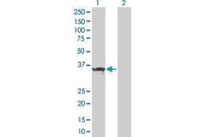 Western Blot analysis of ZBTB32 expression in transfected 293T cell line by ZBTB32 MaxPab polyclonal antibody. (ZBTB32 抗体  (AA 1-302))