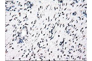 Image no. 1 for anti-Nuclear Receptor Binding Protein 1 (NRBP1) antibody (ABIN1499822) (NRBP1 抗体)