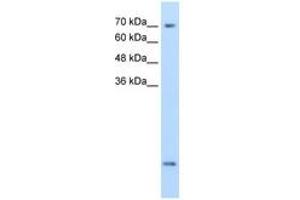 Image no. 2 for anti-Solute Carrier Family 6 (Neurotransmitter Transporter, Creatine), Member 8 (SLC6A8) (AA 200-249) antibody (ABIN204991)