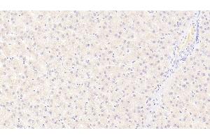 Detection of S100A9 in Human Liver Tissue using Monoclonal Antibody to S100 Calcium Binding Protein A9 (S100A9)