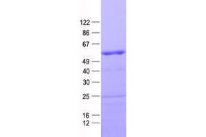 Validation with Western Blot (HOXD10 Protein (His tag))