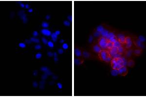 Human epithelial carcinoma cell line HEp-2 was stained with Mouse Anti-Human CD44-UNLB and DAPI. (山羊 anti-小鼠 Ig (Heavy & Light Chain) Antibody (beta-Gal))