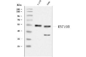 Western blot analysis of WNT10B using anti-WNT10B antibody (ABIN7603104).
