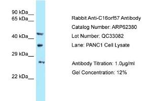 Western Blotting (WB) image for anti-U6 SnRNA Biogenesis 1 (USB1) (C-Term) antibody (ABIN2789122) (C16orf57 抗体  (C-Term))