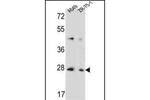 T4S4 Antibody (N-term) (ABIN653705 and ABIN2843022) western blot analysis in A549,ZR-75-1 cell line lysates (35 μg/lane). (TM4SF4 抗体  (N-Term))