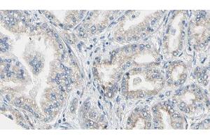 ABIN6276867 at 1/100 staining Human prostate tissue by IHC-P. (FTL 抗体  (C-Term))