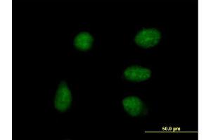 Immunofluorescence of purified MaxPab antibody to DPPA4 on HeLa cell. (DPPA4 抗体  (AA 1-304))