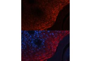 Immunofluorescence (IF) image for anti-S100 Calcium Binding Protein A8 (S100A8) (AA 1-93) antibody (ABIN7270129)