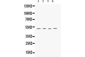 Anti- Keratocan Picoband antibody, Western blottingAll lanes: Anti Keratocan  at 0. (KERA 抗体  (C-Term))