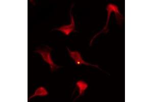 ABIN6269218 staining A2780 by IF/ICC. (AKT2 抗体  (C-Term))