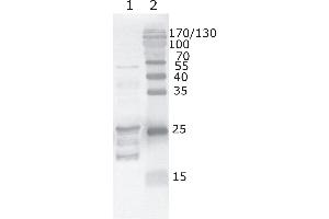 Western Blot testing of HIV-1 recombinant Tat protein. (HIV-1 Tat 抗体  (AA 59-67))