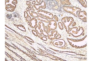 ABIN190842 (6µg/ml) staining of paraffin embedded Human Prostate. (Kallikrein 2 抗体  (Internal Region))
